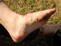 DSC 5551  Amy's foot. The casualties could have been far worse. We did well!