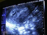 IMGP4584  THIS is the wee surprise that came along space-a with us! We had no idea there was a baby Krug #2 in there, but alas, here he or she is! I'm 5 weeks. Say some prayers this one stays put :) We are hopeful, and I've had the kindest people work me into their clinic schedule this week before I head out on the road again. Amazing people I've met along the way. I couldn't ask for better medical care.