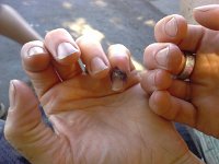 20160820 142453  My finger is getting better, though. Nails a tad dirty from camping.